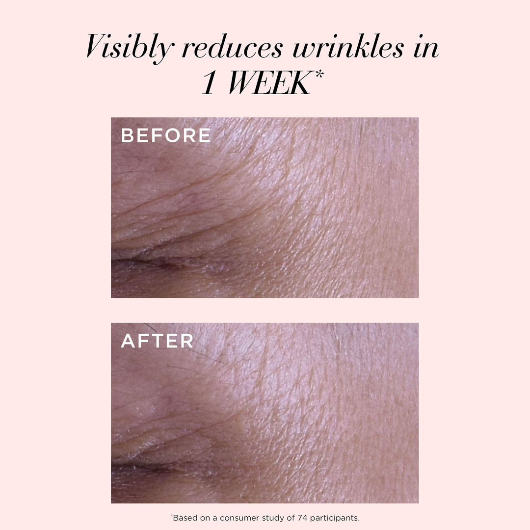 Visibly reduces wrinkles in 1 week based on a consumer study of 74 participants