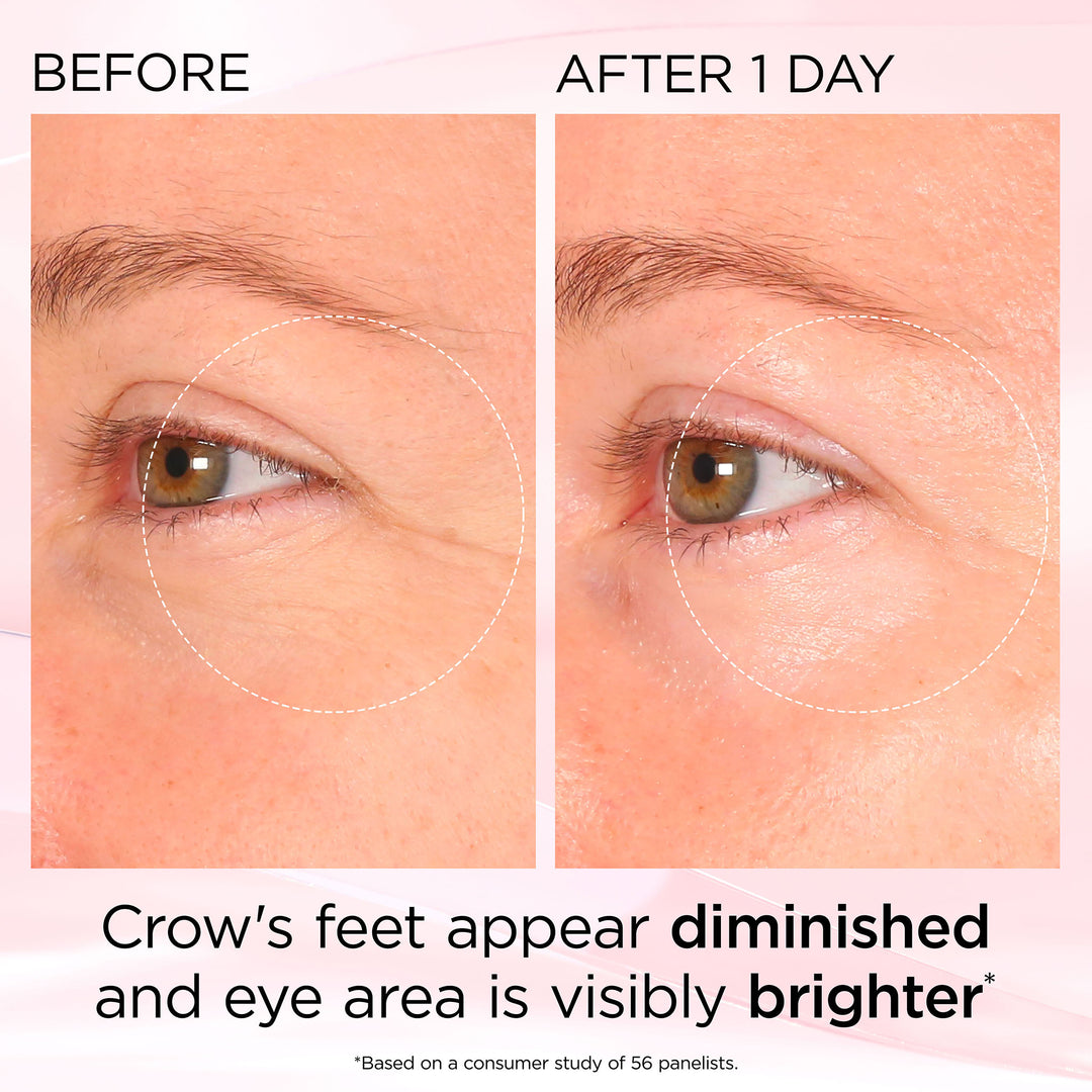 Before and After 1 Day. Crow's feet appear diminished and eye area is visibly brighter* *Based on a consumer study of 56 panelists. 