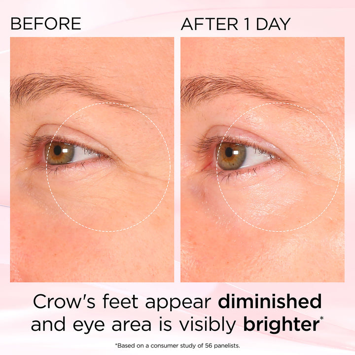 Before and After 1 Day. Crow's feet appear diminished and eye area is visibly brighter* *Based on a consumer study of 56 panelists. 