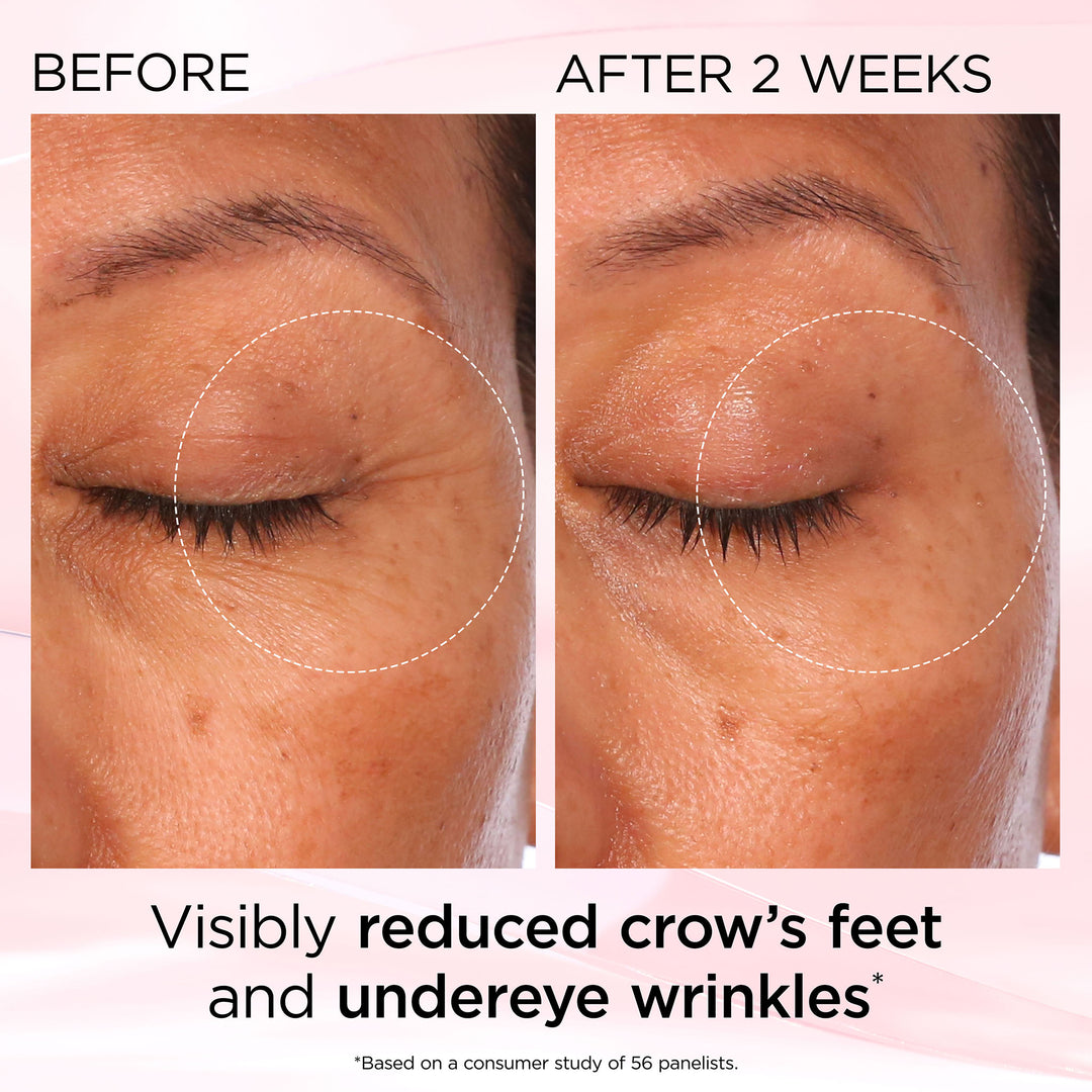 Before and After 2 Weeks. Visibly reduced crow's feet and undereye wrinkles* *Based on a consumer study of 56 panelists.