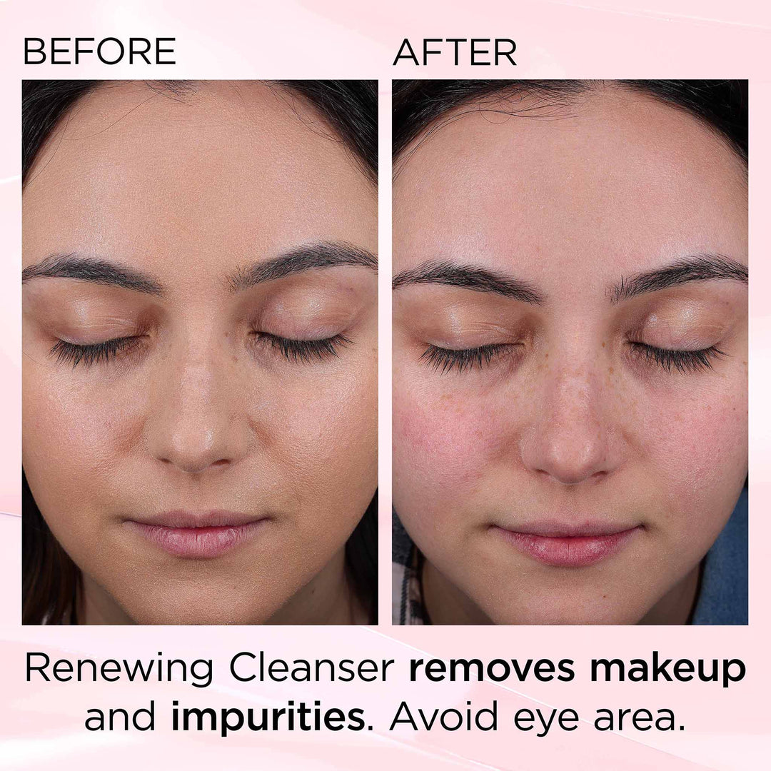 Ceramide Skin Renewing Cleanser