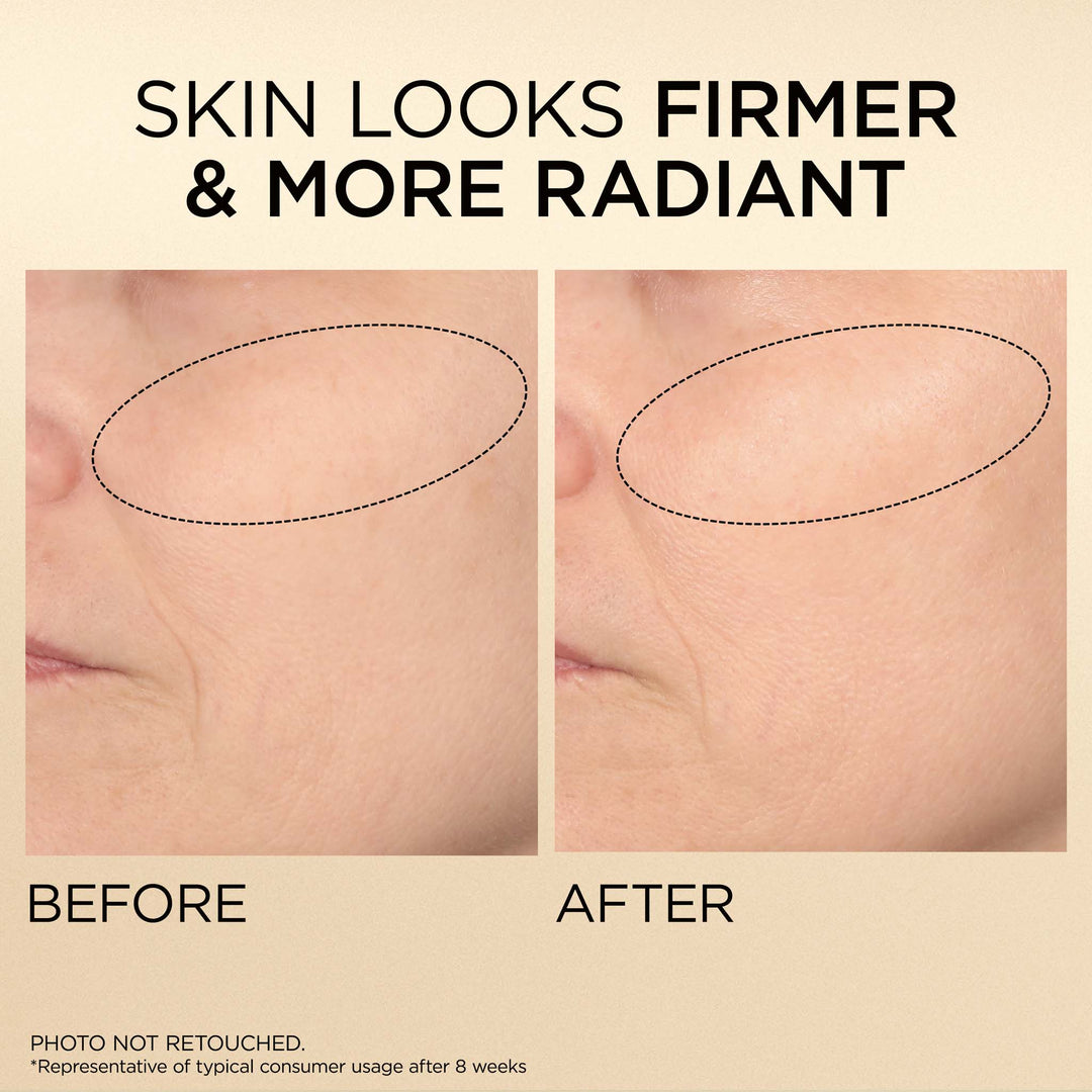 Skin looks firmer and more radiant. Photo is not retouched. *Representative of typical consumer usage after 8 weeks.