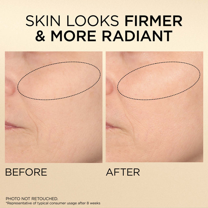 Skin looks firmer and more radiant. Photo is not retouched. *Representative of typical consumer usage after 8 weeks.